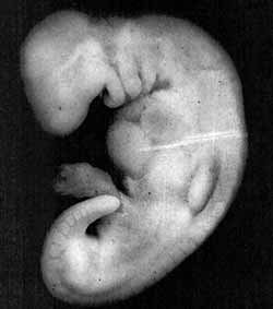 http://www.whyislam.in/files/theme/HumanEmbryonic5.jpg